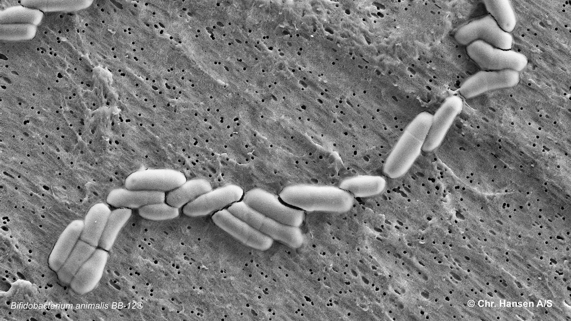 Mikroskopibild av bifidobakterier