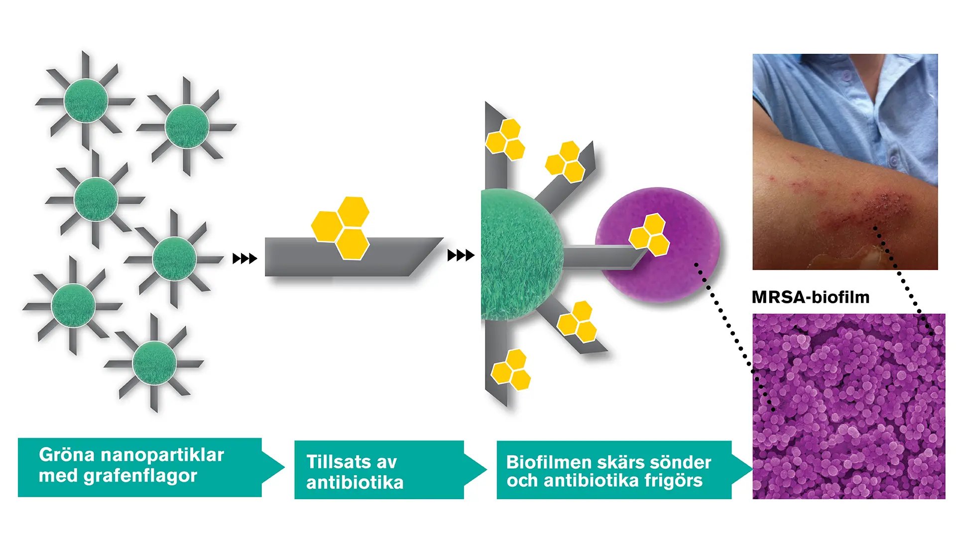 Nanopartiklar laddade med vassa grafenflagor, illustration
